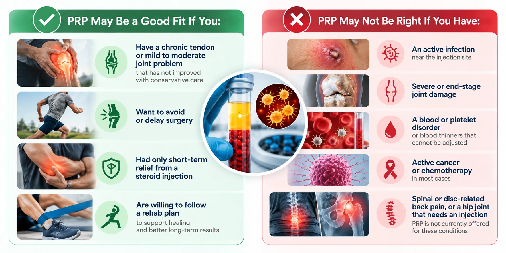 Who Is a Good Candidate for PRP