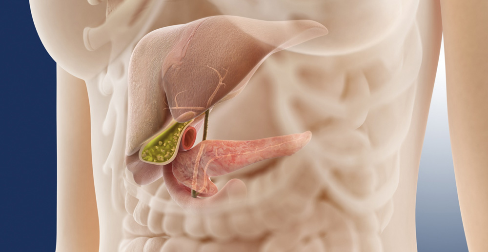 More Antibiotics, Higher Odds for Colon Cancer?