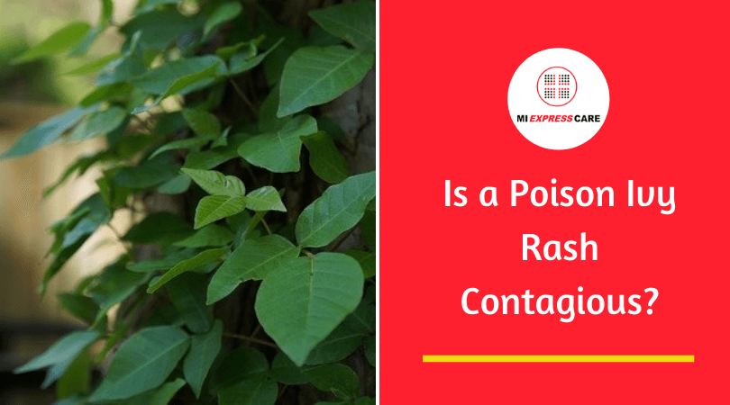Is a Poison Ivy Rash Contagious?