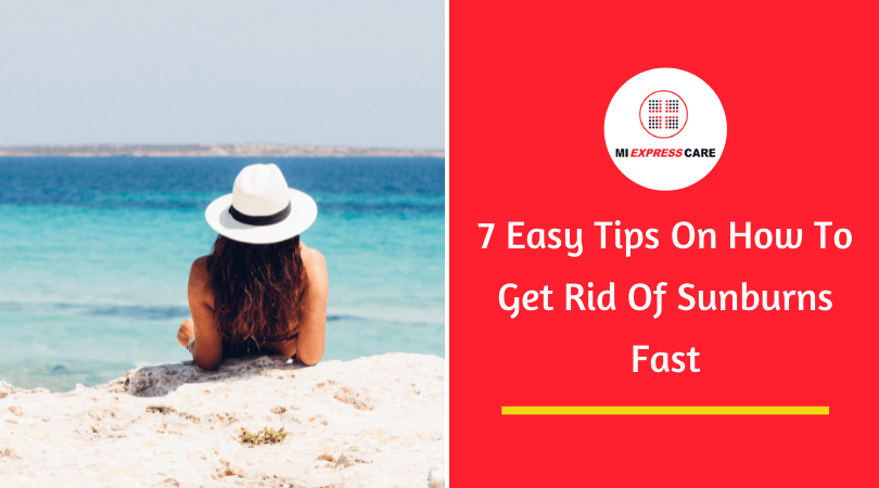 7 Easy Tips On How To Get Rid Of Sunburns Fast
